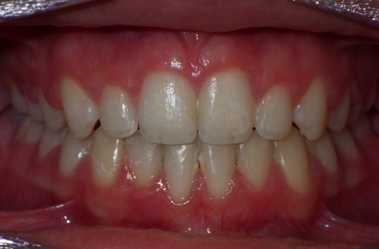 Common Treatments_after Common Treatments_after