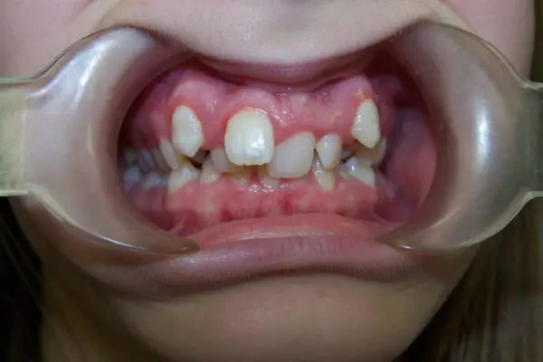 Common Treatments_before Common Treatments_before